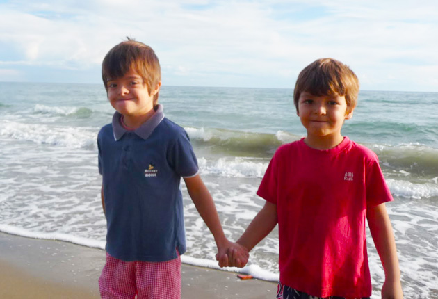 Hermanos gemelos, uno con síndrome de Down y otro no