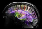 Afinando los circuitos cerebrales se podría obtener significativas mejoras en el tratamiento del autismo