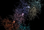 El mapa de conexiones entre neuronas en el cerebro de una persona con autismo