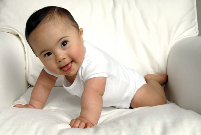 Un feto con síndrome de Down y su gemelo sin esta condición desvelan la clave genética del trastorno
