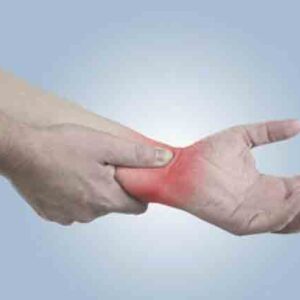 Artritis Reumatoide: Mientras más conocimiento mejor