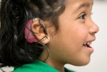Implante ayuda a romper la barrera del sonido a niños sordos