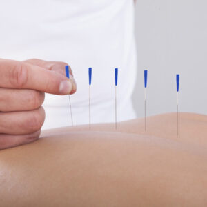 Beneficios de la acupuntura en el embarazo