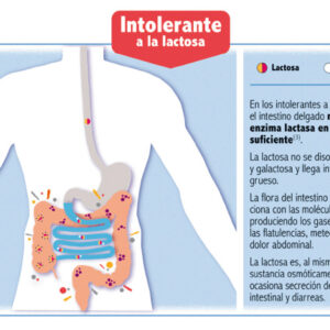 Representación gráfica de la intolerancia a la lactosa