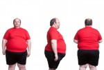 Hombre obeso