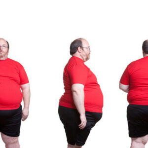 Hombre obeso