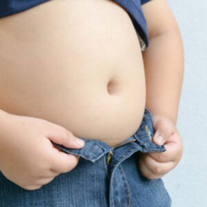 Obesidad infantil.