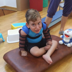 Parálisis cerebral.