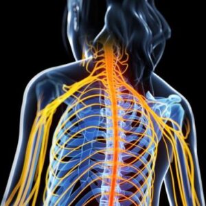 Esclerosis múltiple