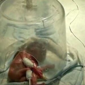 Bebé prematuro