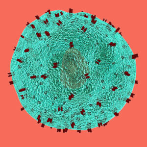 Esclerosis múltiple
