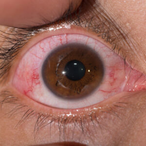 Ojo