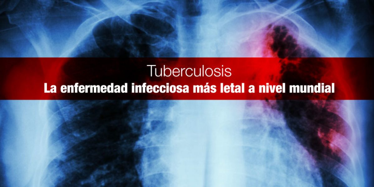 La tuberculosis es curable y se puede prevenir - Todos ...
